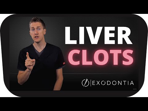 How To Manage Liver Clots | OnlineExodontia.com