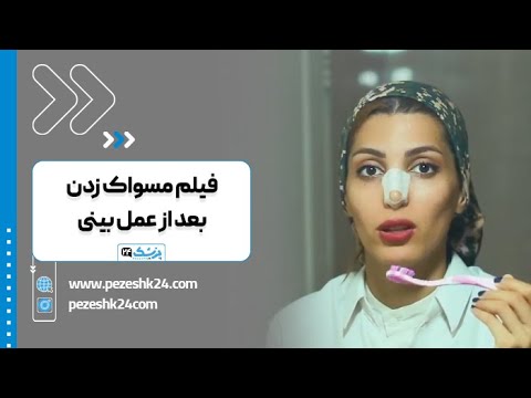 روش صحیح مسواک زدن بعد عمل بینی چیست پزشک 24
