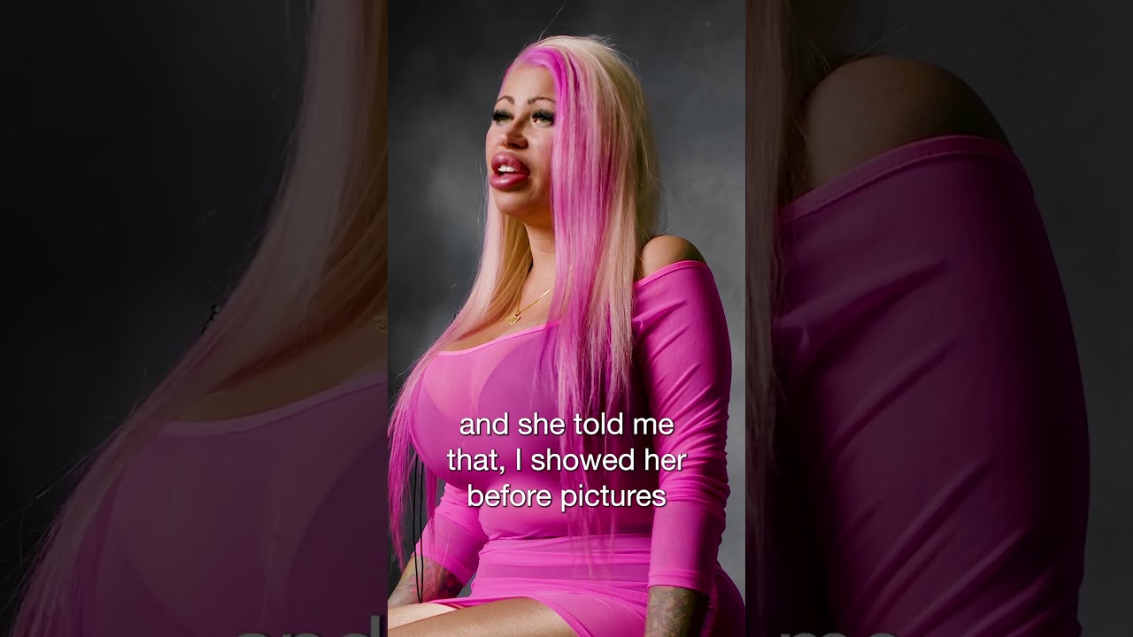 Plastic Surgery Addict-Elaina