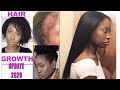 HOW TO GROW HAIR & BALD EDGES BACK LONG Natural Hair Growth Journey Update, Products & Tips 2020