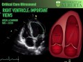 Right Ventricular Function in Critical Illness