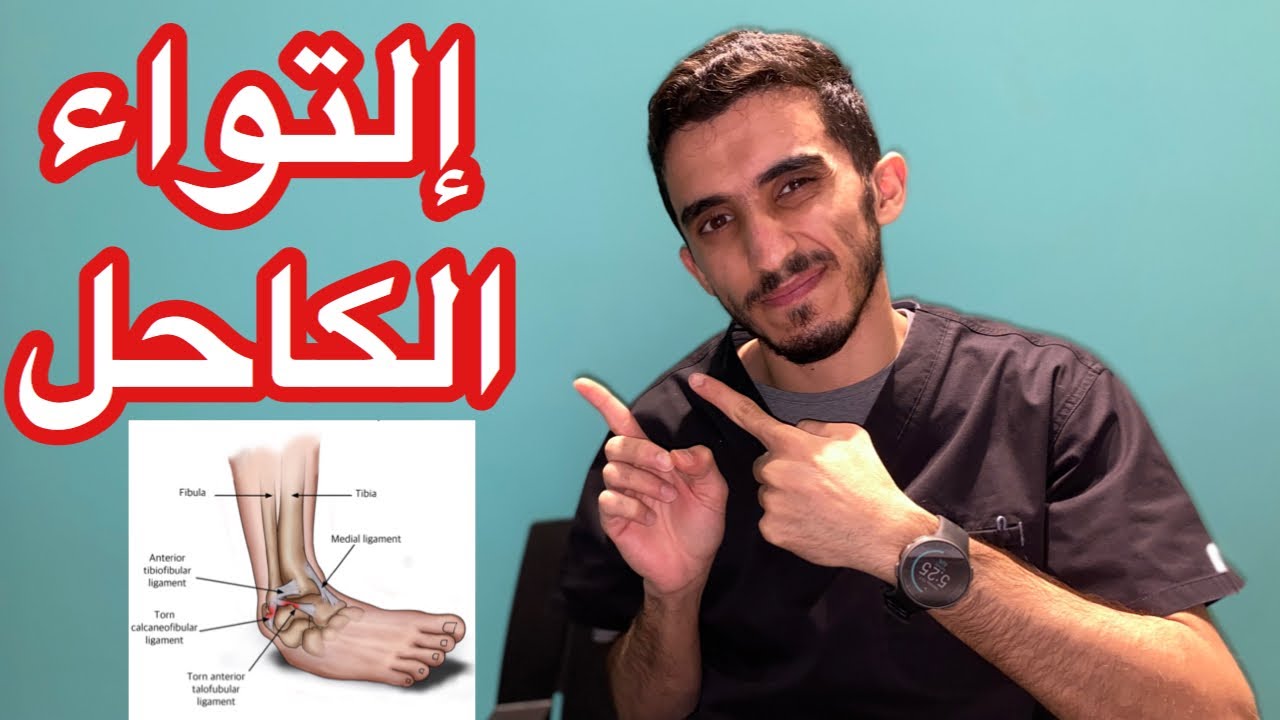وش تسوي لو صار لك إلتواء في الكاحل ؟ 🤕🚨