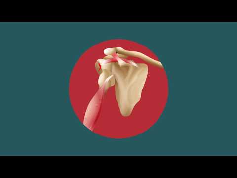 AJE Video Bytes