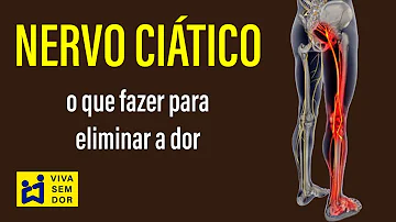 O que fazer para descomprimir o nervo ciático?