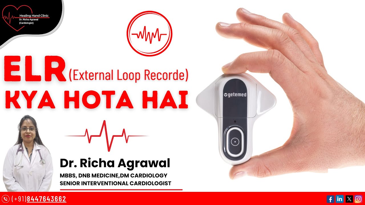 ELR (External Loop Recorder): Kya Hota Hai? | Dr. Richa Agrawal | Senior Interventional Cardiologist