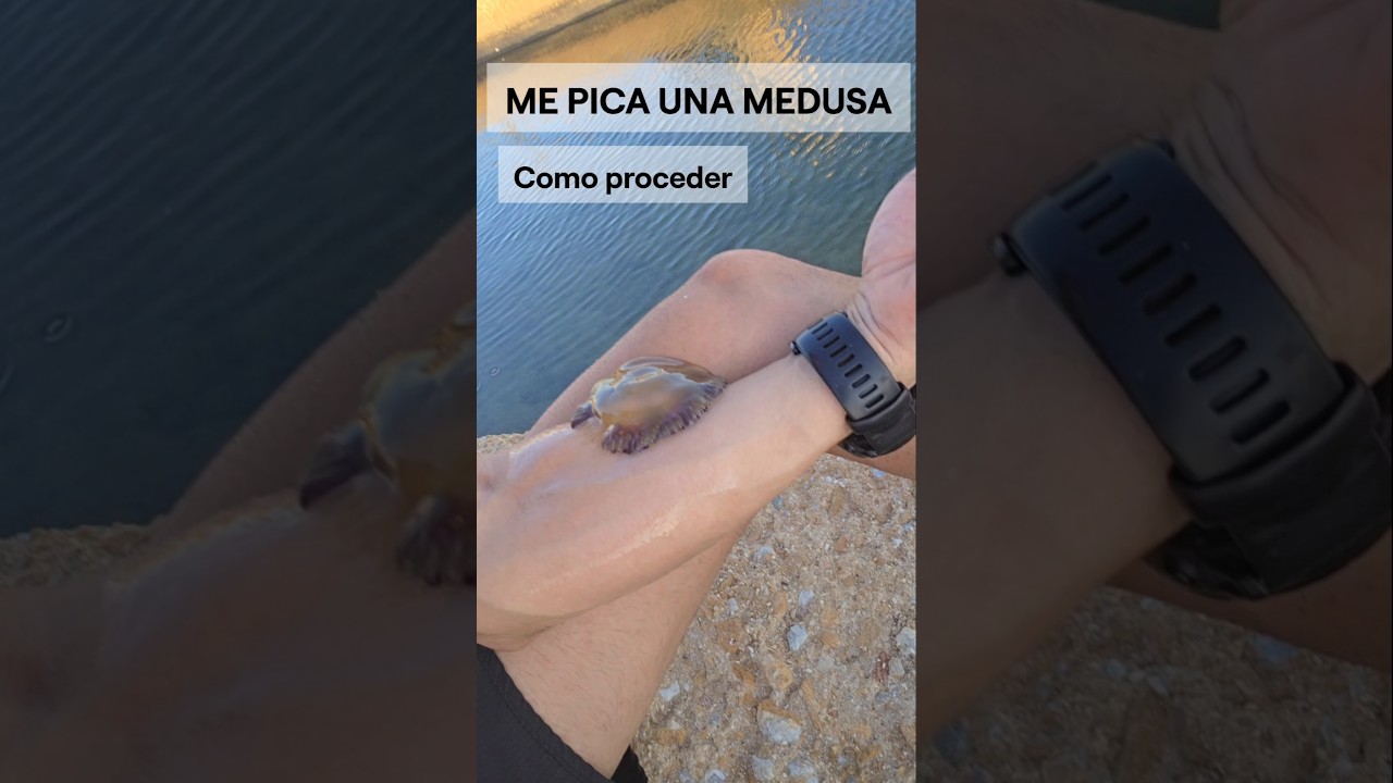 Me pica una medusa. Como proceder.#supervivencia #sabiasque #curiosidades
