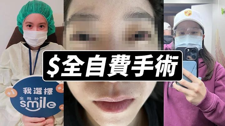 100度也要自费近视雷射，我手术后遗症有哪些？真的有网路上讲得那么厉害吗？#Smile雷射手术 #轻度近视 - 天天要闻
