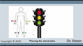12 lead ECG placement of electrodes | procedure explained, animation