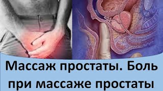 Можно ли делать массаж при аденоме простаты?