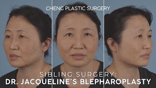 Sibling Surgery: Dr. Jacqueline’s Upper Blepharoplasty PART 1