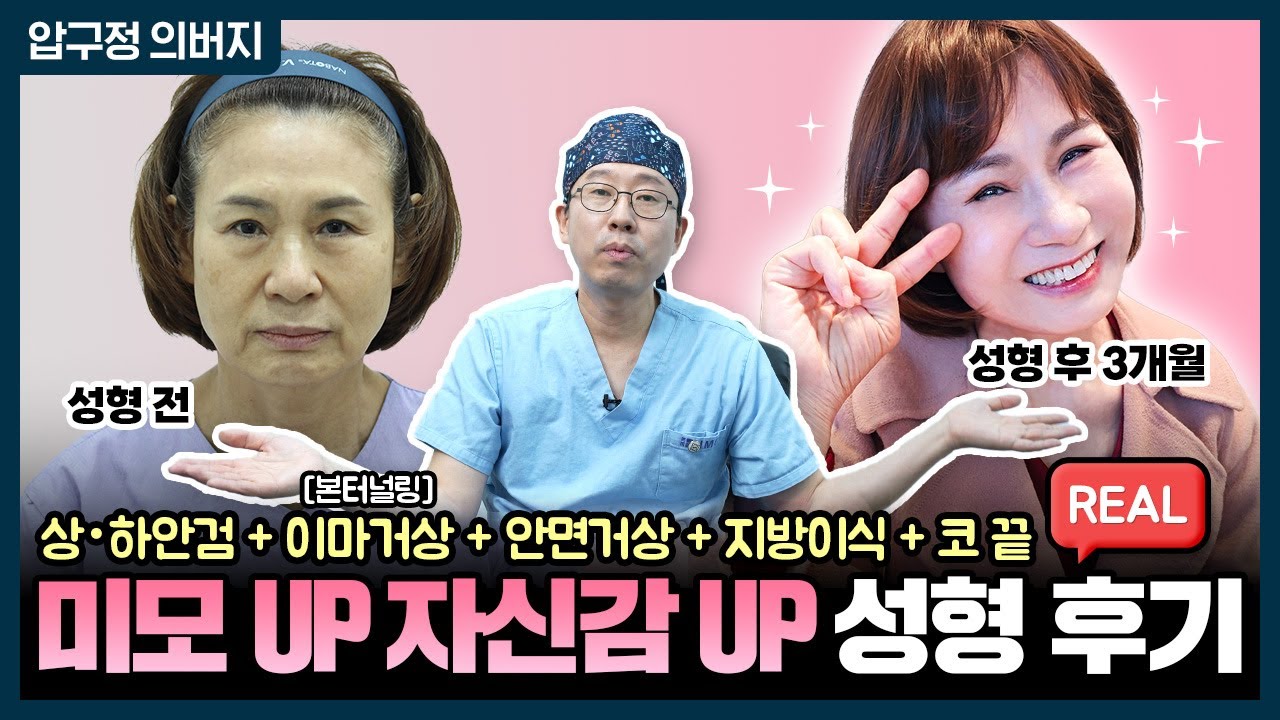 [60대 동안성형] ✨3개월간의 변화!✨ 리얼 후기!