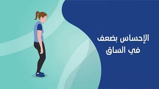 أعراض عرق النسا