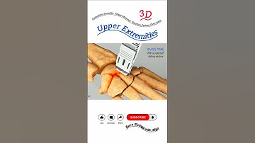 OsteoMed InstaFix Shape Memory Fixation System Overview - Upper Extremities #3d #shorts