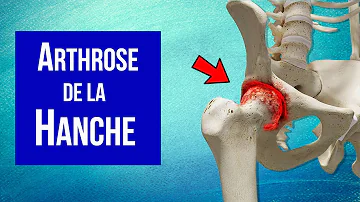 Où se situe les hanches sur le corps ?