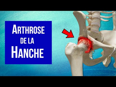 Vidéo: Quel est le contraire de hanche ?