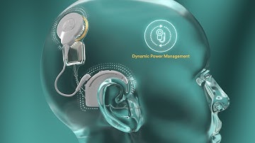 Nucleus Nexa by Cochlear - Medical Product Animation