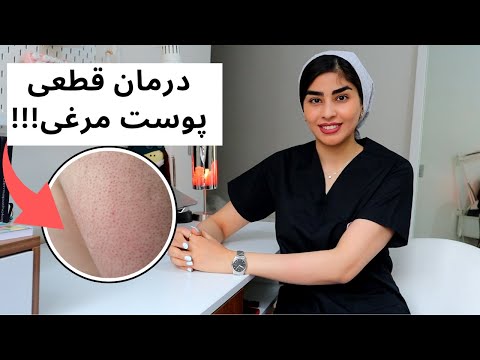 کراتوز پیلار راهنمای درمان متخصص پوست