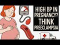 Preeclampsia vs Eclampsia for NREMT Students