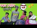 বন্ধন গোটৰ লোণ লৈ mobile কিনি দিলত😂একেদিনাই মাইকীয়ে এৰি পলাই গ'ল🤣Assamese comedy video