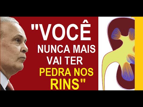 Como acabar com as pedras nos rins - Dr. Lair Ribeiro