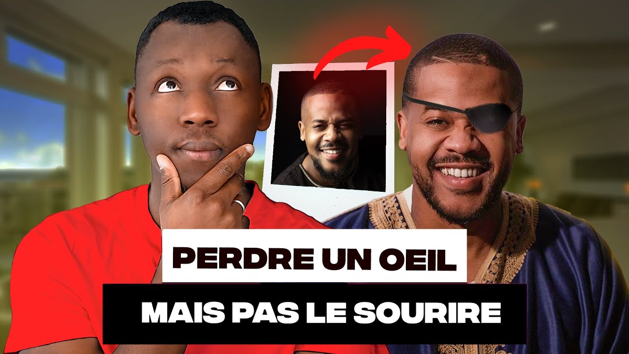 Il a perdu son oeil mais pas son sourire - INCROYABLE - YouTube