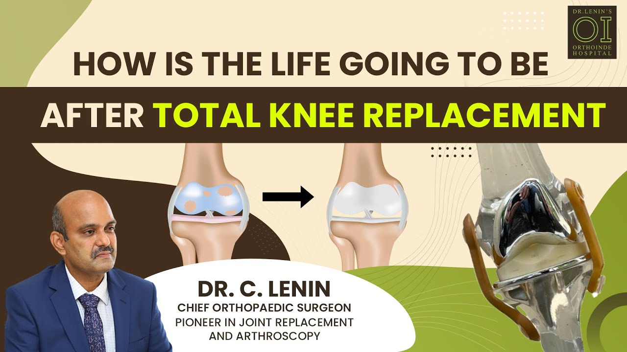 Life After Total Knee Replacement Surgery: What to Expect | Best ...