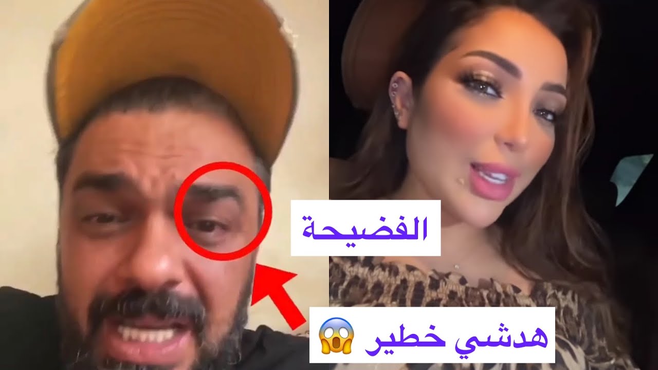 هستيريا دنيا بطمة وزوجها محمد الترك وتحفة