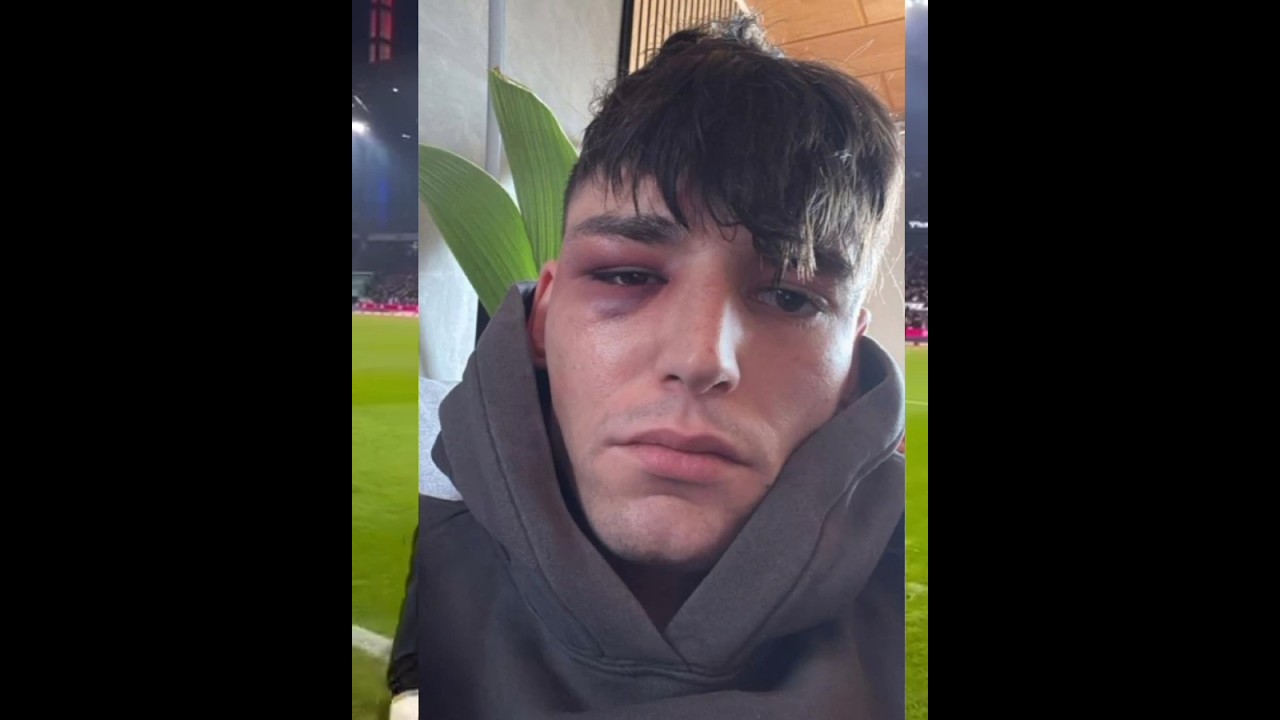 Pascal Káiser y la DOBLE MORAL de los FIFES