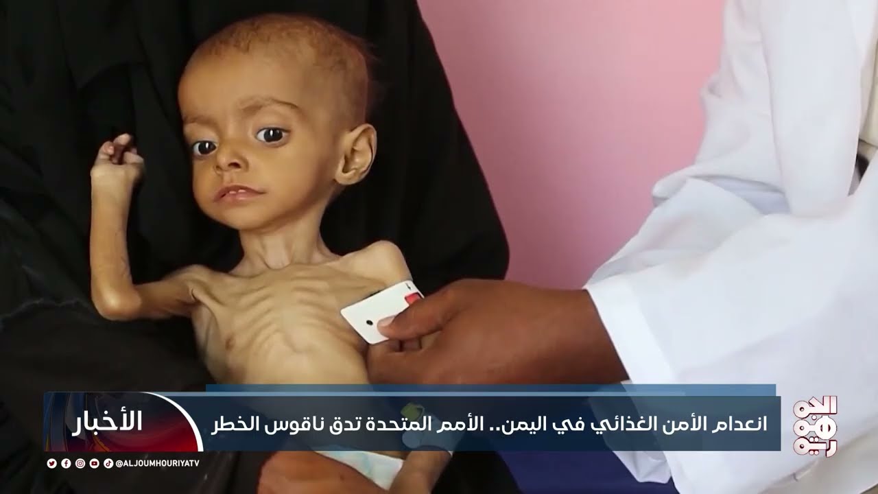 انعدام الأمن الغذائي في #اليمن... الأمم المتحدة تدق ناقوس الخطر