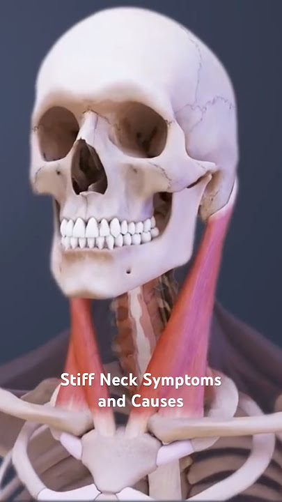 Stiff Neck Symptoms and Causes
