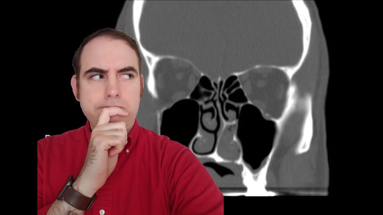 Mystery Case Challenge: How an Oral Pathologist Works Up an Unknown Case