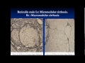 pathology - dr. Dhaymaa -- Liver cirrhosis & Jaundice