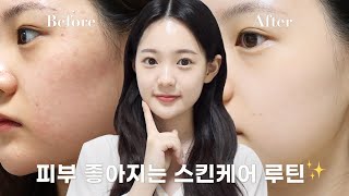 피부 좋아지는 스킨케어 루틴 공개합니다✨(트러블흉터/좁쌀 여드름/트러블/붉은기) & 이벤트🎁 | 유채 YUCHAE