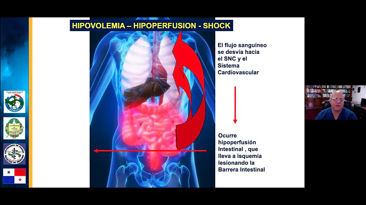 Clase #1: Respuesta Sistmica a la lesin y apoyo me...