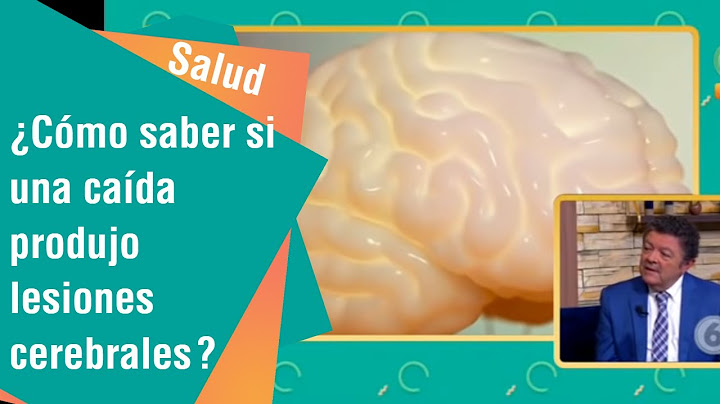 ¿Cómo saber si una caída produjo lesiones cerebrales? | Salud