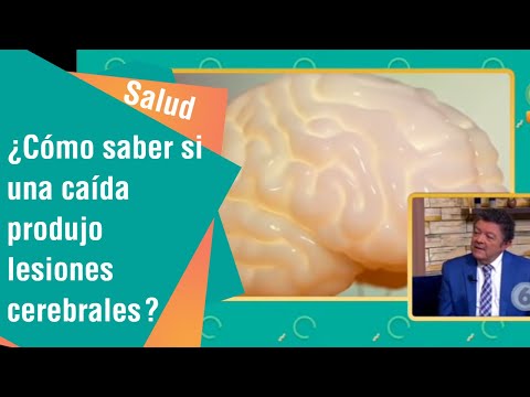 Vídeo: Golpe En El Techo De La Boca: 10 Causas Posibles