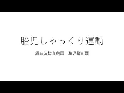 胎児しゃっくり運動（超音波動画）