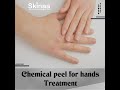 Chemical peel for hands treatment at skinaa clinic  viral shorts