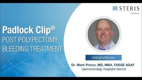 PADLOCK CLIP™ System | Post Polypectomy Bleeding Treatment – Dr. Mark Prince
