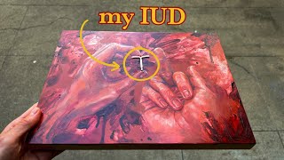 my IUD ruined my life...so i made a painting with it