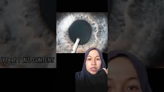 Orang Buta Melihat Dunia Untuk Pertama Kali #shorts