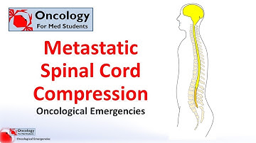 Metastatic spinal cord compression