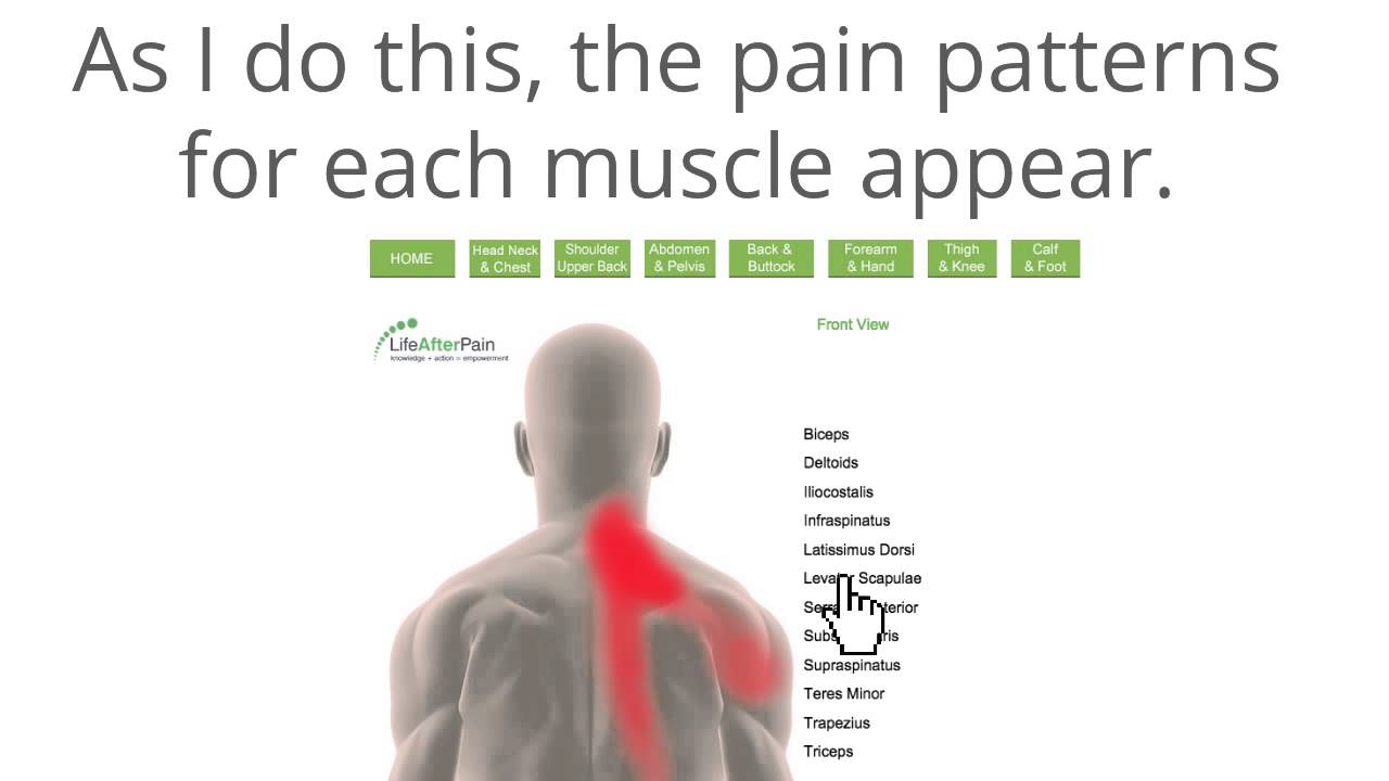 Trigger Point Charts Free