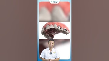 Nong Hàm Có Đau Không ? | Bác Sĩ Yên