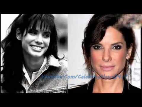 Courteney Cox Plastic Surgery Before And After Hd Youtube