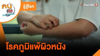 โรคภูมิแพ้ผิวหนัง : รู้สู้โรค