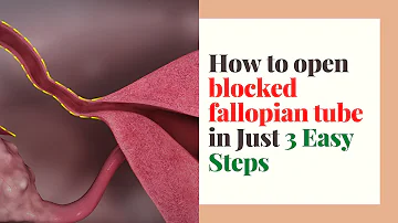 How to open blocked fallopian tube in Just 3 Easy Steps (And Get Pregnant Naturally)