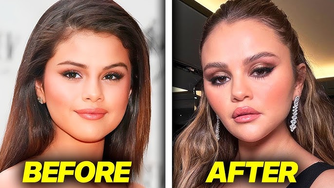Selena Gomez PLASTIC SURGERY Backlash (fans aren't loving it) - YouTube