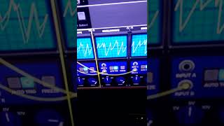 Behringer 2600 Output to Output Patching Trick