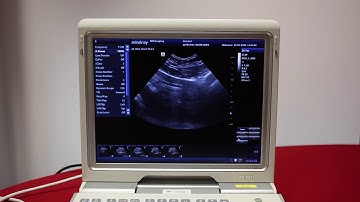 Mindray Z6: How to export images on the Z6 - video 9